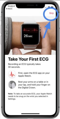 ECG Apple Watch App: Everything you need to know!